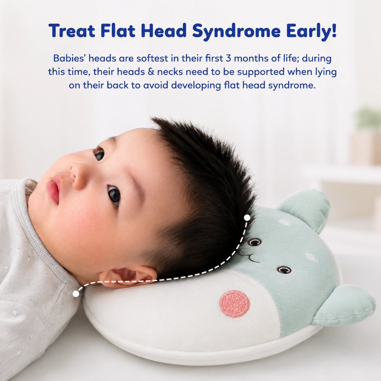 Cloudy Cat Design Baby Head Shaping Pillow – Pack of 1